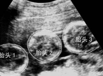 2026年没有结婚证可以到上海私立医院做试管吗？